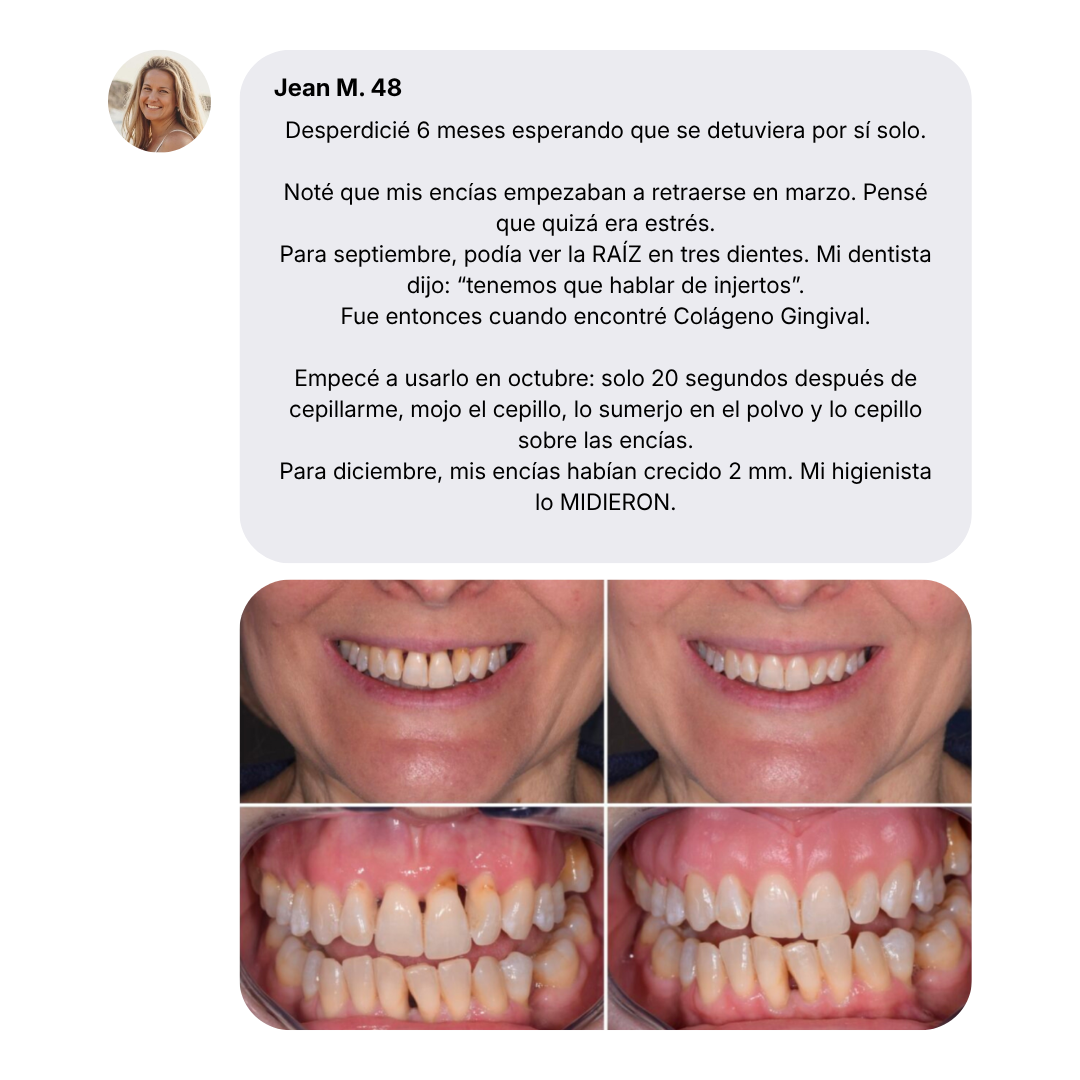 Nudent Gingival Maritime Collagen — Encías retraídas y regeneración del tejido