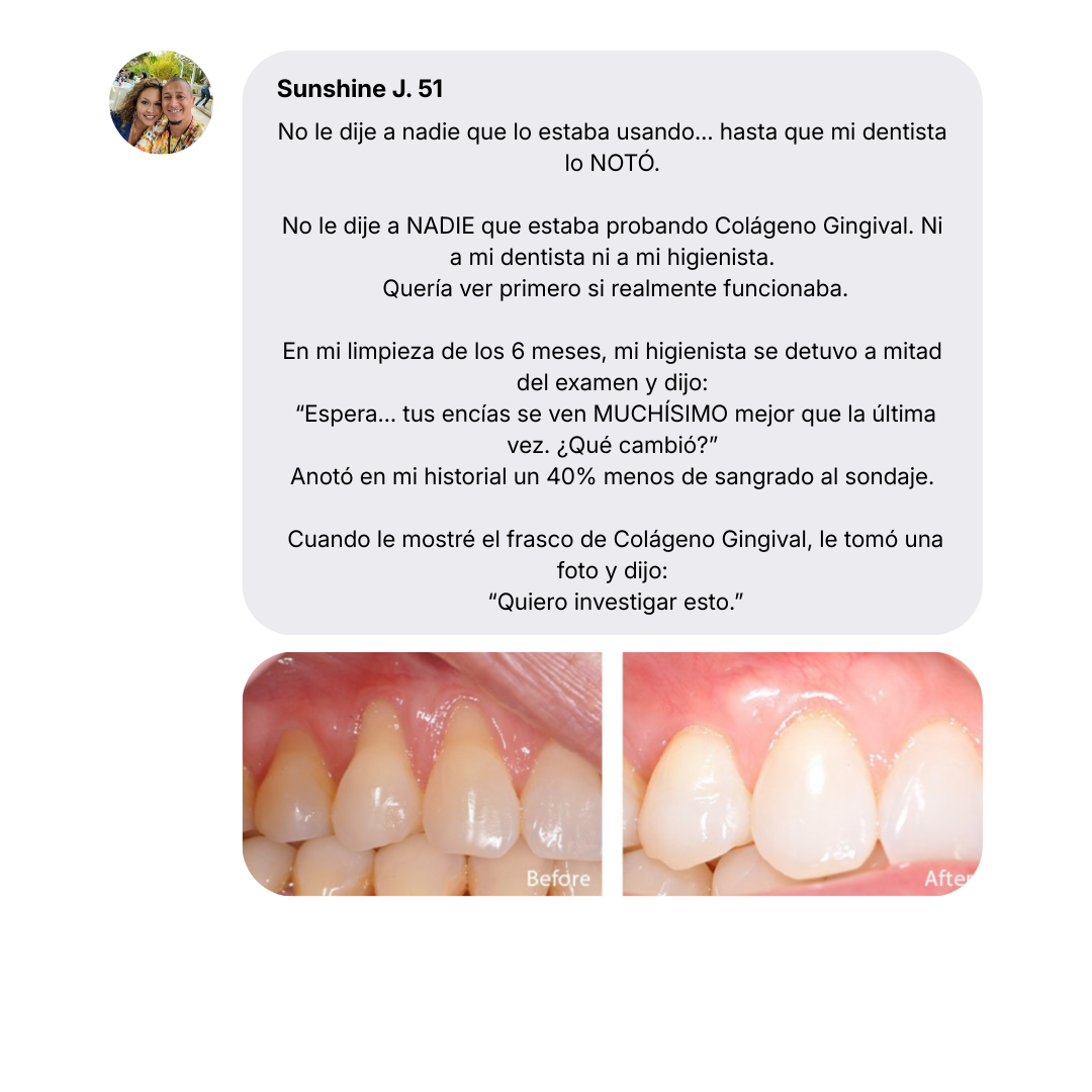 Blanqia Colágeno Gingival