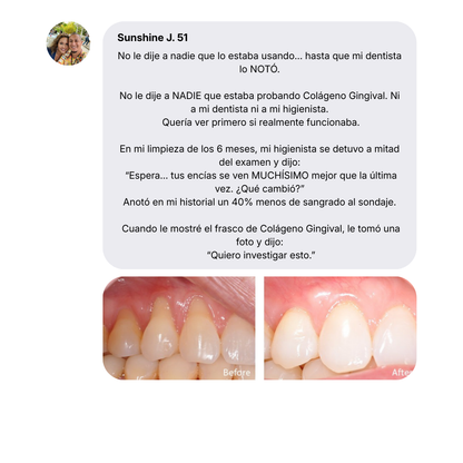 Blanqia Colágeno Gingival
