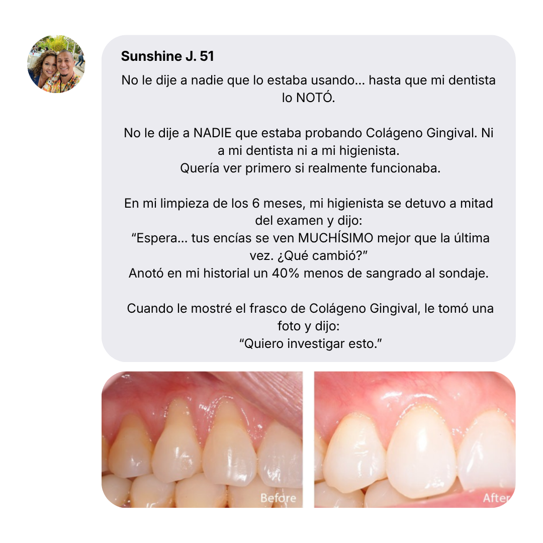 Nudent Gingival Maritime Collagen — Encías retraídas y regeneración del tejido
