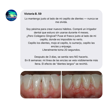 Nudent Gingival Maritime Collagen — Encías retraídas y regeneración del tejido